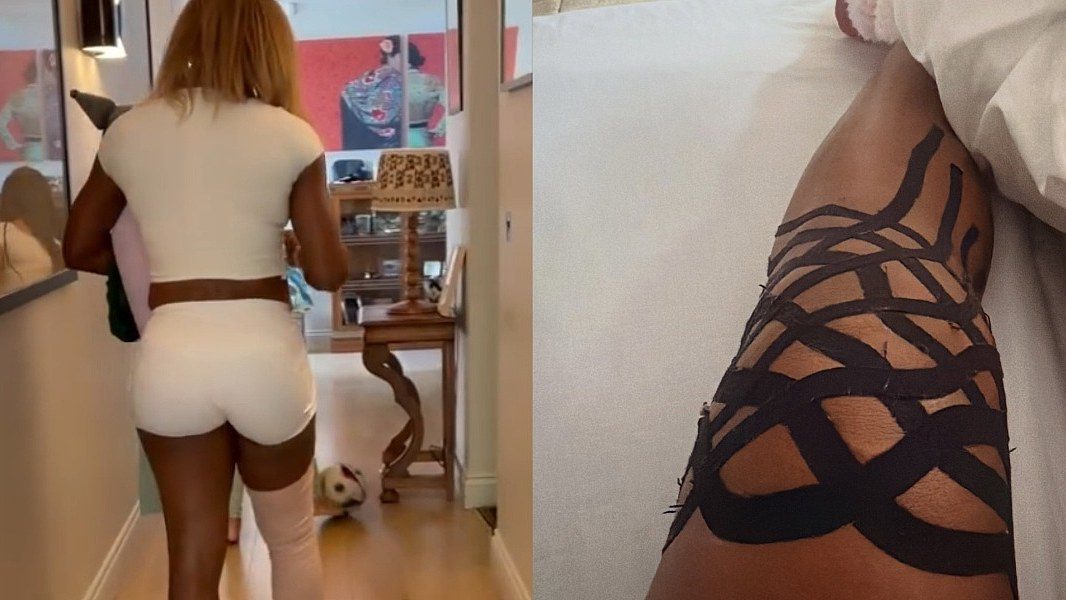 Serena Williams odustala od dubla sa sestrom Venus na Wimbledonu zbog povrede koljena